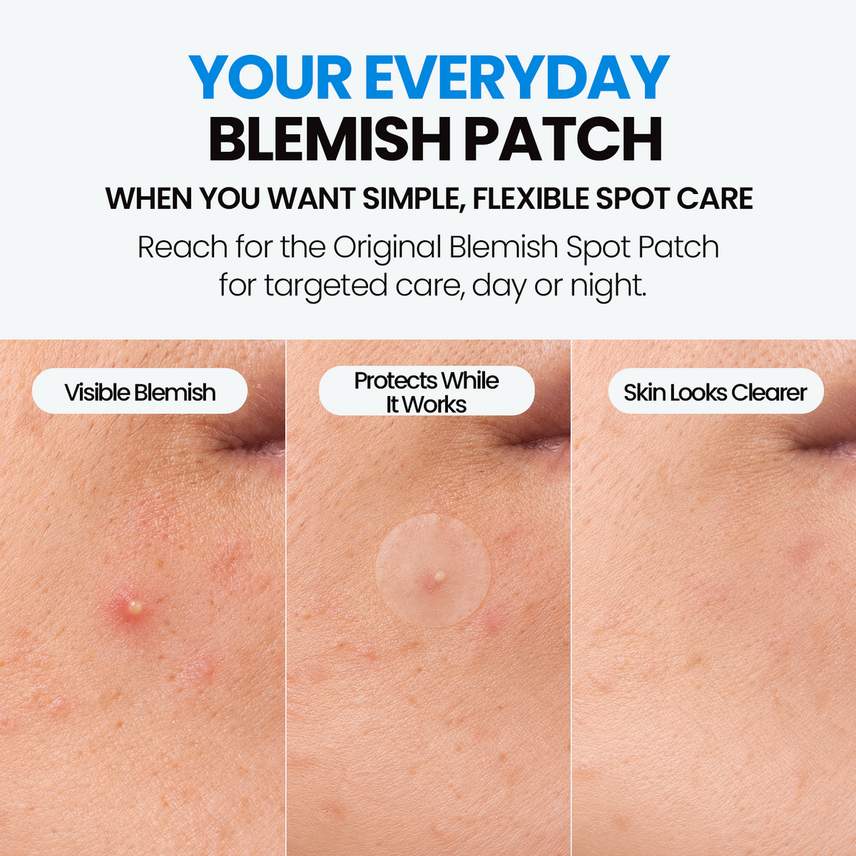 epielle Original Beveled Edge Blemish Spot Patch